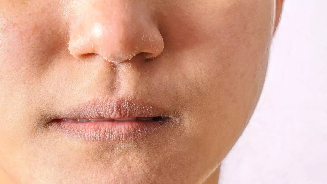 Mineralien und Vitamine für trockene Haut im Herbst: Tipps und Tricks
